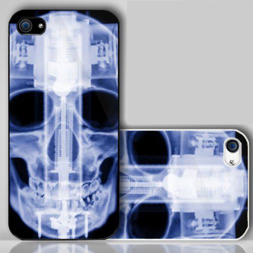 XRay Skull   iPhone Case Cover    197