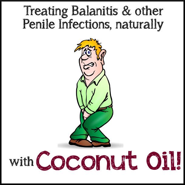 AHybrid Rasta Mama : Treating Balanitis & other Penile Infection Naturally, with Coconut Oil Hybrid Rasta Mama : Treating Balanitis & other Penile Infection Naturally, with Coconut Oil